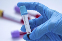 Dvoje preminulo od virusa korona u RS, potvrđeno devet novozaraženih