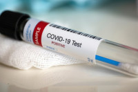 Osam osoba iz FBiH pozitivno na virus korona, zaraženo i dijete