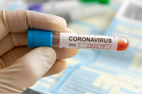 Još 53 slučaja zaraze u Srpskoj, najviše u Banjaluci i Ljubinju