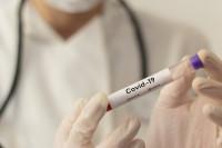 U Srpskoj virus potvrđen kod još 40 osoba