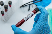 RS kupuje dodatnih 50.000 brzih testova na virus korona