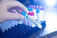 U Srpskoj 84 slučaja virusa korona