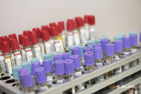 Šta nam govore rezultati seroloških ispitivanja na virus korona?