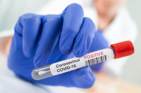 Još 39 osoba novozaraženo u Srpskoj