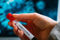 U Srpskoj 57 novih slučajeva virusa korona