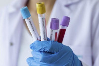 U Srpskoj na virus korona pozitivno 97 osoba