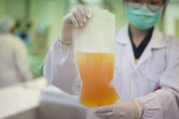 Hoće li i u BiH početi liječenje krvnom plazmom