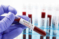 Još 129 osoba u Srpskoj pozitivno na virus korona
