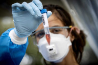 Korona virus potvrđen kod još 141 osobe u Srpskoj, preminula tri pacijenta