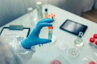 Novi dnevni rekord u BiH: Virusom korona zaražena još 1.251 osoba