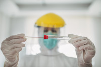 Osobe s lakšom kliničkom slikom neće biti testirane