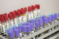 PREMINULA 23 OBOLJELA Korona virusom zaraženo još 609 osoba u Srpskoj