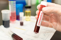 Privatne ambulante ne mogu da vrše PCR testiranja