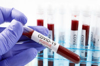 U Srpskoj još 20 smrtnih slučајеva i 416 novooboljelih