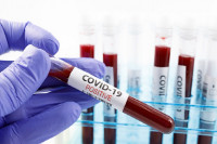 NA VIRUS TESTIRANO 273 GRAĐANA Zaraženo još 83, umrlo 26 ljudi