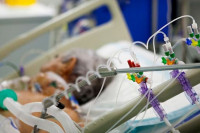 Dr Lukić ističe da mehanička ventilacija POVEĆAVA RIZIK za kardiovaskularne probleme