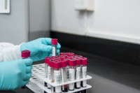 U Srpskoj još 97 ljudi pozitivno na korona virus, 14 osoba preminulo