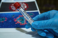 Na korona virus pozitivno još 56 građana Srpske, preminulo osam zaraženih