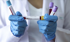 U Srpskoj koronom zaraženo još 40 osoba