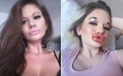 Ovo je djevojka s jednim od najvećih usana na svijetu