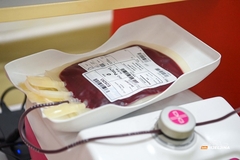 Bijeljinki hitno potrebna pomoć: Poziv za sve ljude sa nulom krvnom grupom