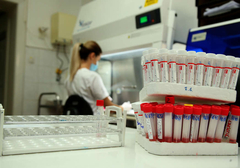 Novi simptom korona virusa: Može se lako pomiješati sa običnom prehladom