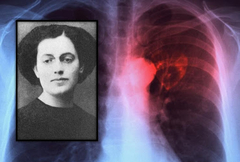 Nadežda Stanojević – prva Srpkinja pedijatar