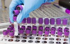 U Srpskoj nema preminulih, jedna osoba zaražena