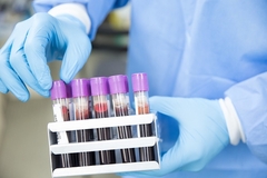Korona virus potvrđen kod još 149 građana Srpske, preminulo 17 oboljelih