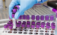 U RS 162 nova slučaja korone, šestoro preminulo