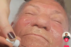 Pjevač iz Bijeljine riješio da se pomladi, pohvalio se na TikToku (VIDEO)