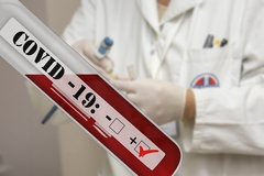 U Srpskoj 458 novooboljelih; Preminulo 26