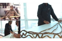 Indijac odsjekao nokte nakon 66 godina: Nijedna žena se nije htjela udati za mene