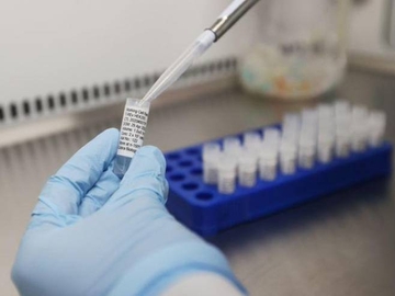 U Sloveniji smanjen broj zaraženih, preminulo 23 oboljelih