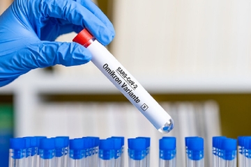 Oštrija pravila za ulazak u Sloveniju od ponedjeljka