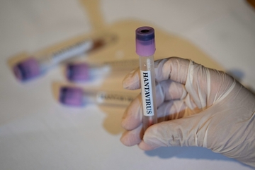 Nakon slučaja na kruzeru pažnja usmjerena na hantavirus: Šta prijeti građanima u BiH