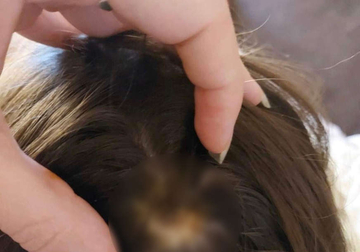 JEZIV SLUČAJ NASILJA Majka kćerkici gasila cigarete po tijelu, baka uzela djecu da ih spasi, pa uhapšena (FOTO)