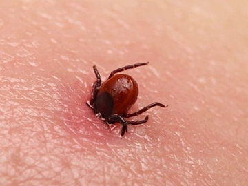 Jedan ujed krpelja promijenio joj život: Majka dvoje djece sada je potpuno nepokretna