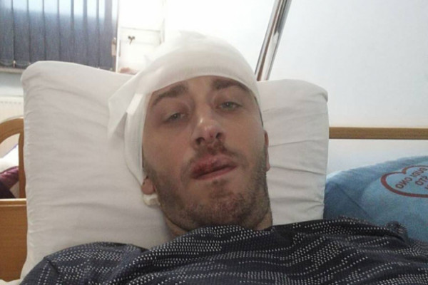 Pretučeni novinar Vladimir Kovačević pušten na kućno liječenje