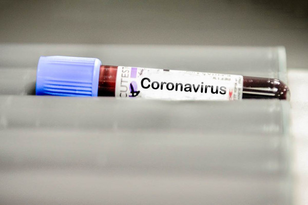 Novi slučaj zaraze virusom korona u FBiH