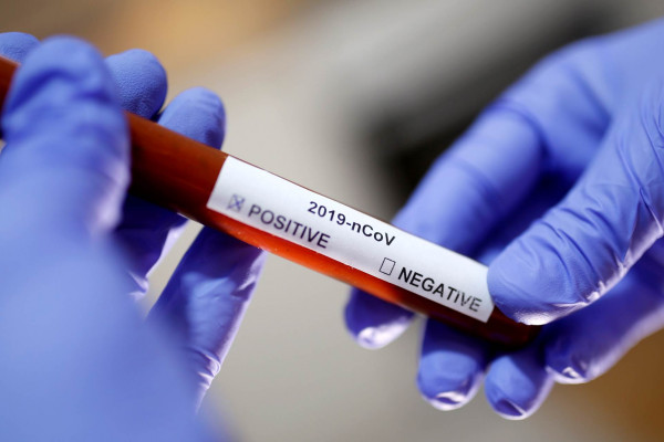 U Srpskoj korona virus potvrđen kod još 15 osoba
