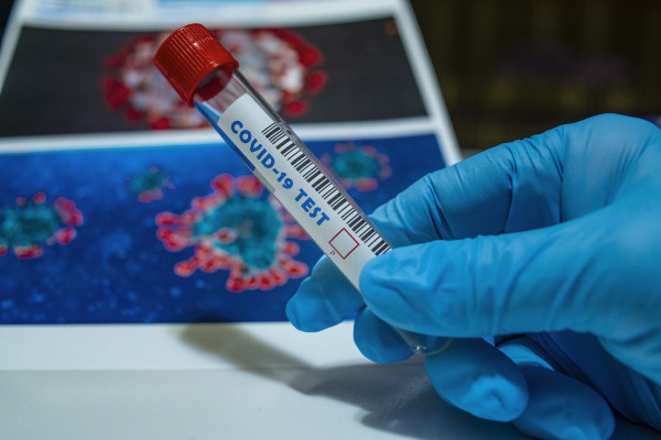 U Srpskoj obavezan test na koronu i za one koji dolaze zbog poslednjeg ispraćaja: Ni na sahranu bez nalaza!