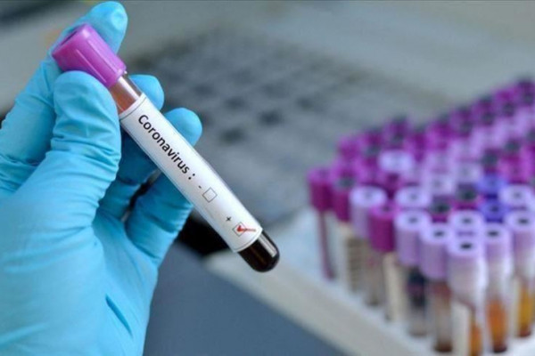 U Srpskoj još 42 osobe pozitivne na virus korona: Dvoje zaraženih iz Bijeljine