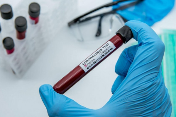 RS kupuje dodatnih 50.000 brzih testova na virus korona