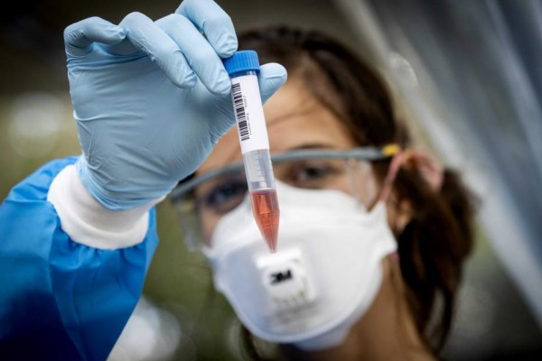 Korona virus potvrđen kod još 141 osobe u Srpskoj, preminula tri pacijenta