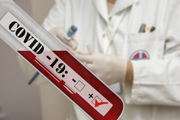  Novi PCR aparat za dijagnostiku virusa korona u Srpskoj