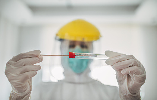 Osobe s lakšom kliničkom slikom neće biti testirane