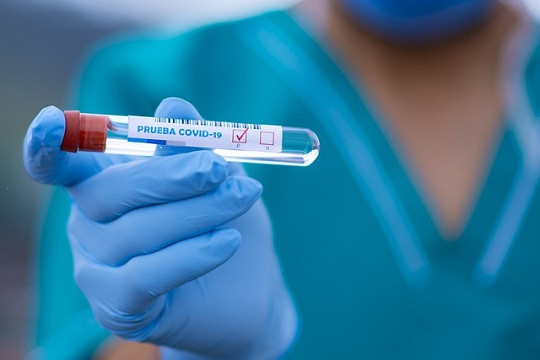 KORONA U BiH SE NE PREDAJE Novozaraženo 1.495 osoba, 30 pacijenata preminulo