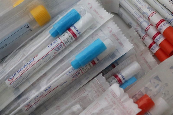 Besplatan test na koronu za žrtve nasilja prilikom smještaja u sigurne kuće