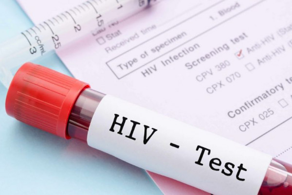U RS tokom godine registrovan jedan slučaj HIV-a, tri osobe preminule